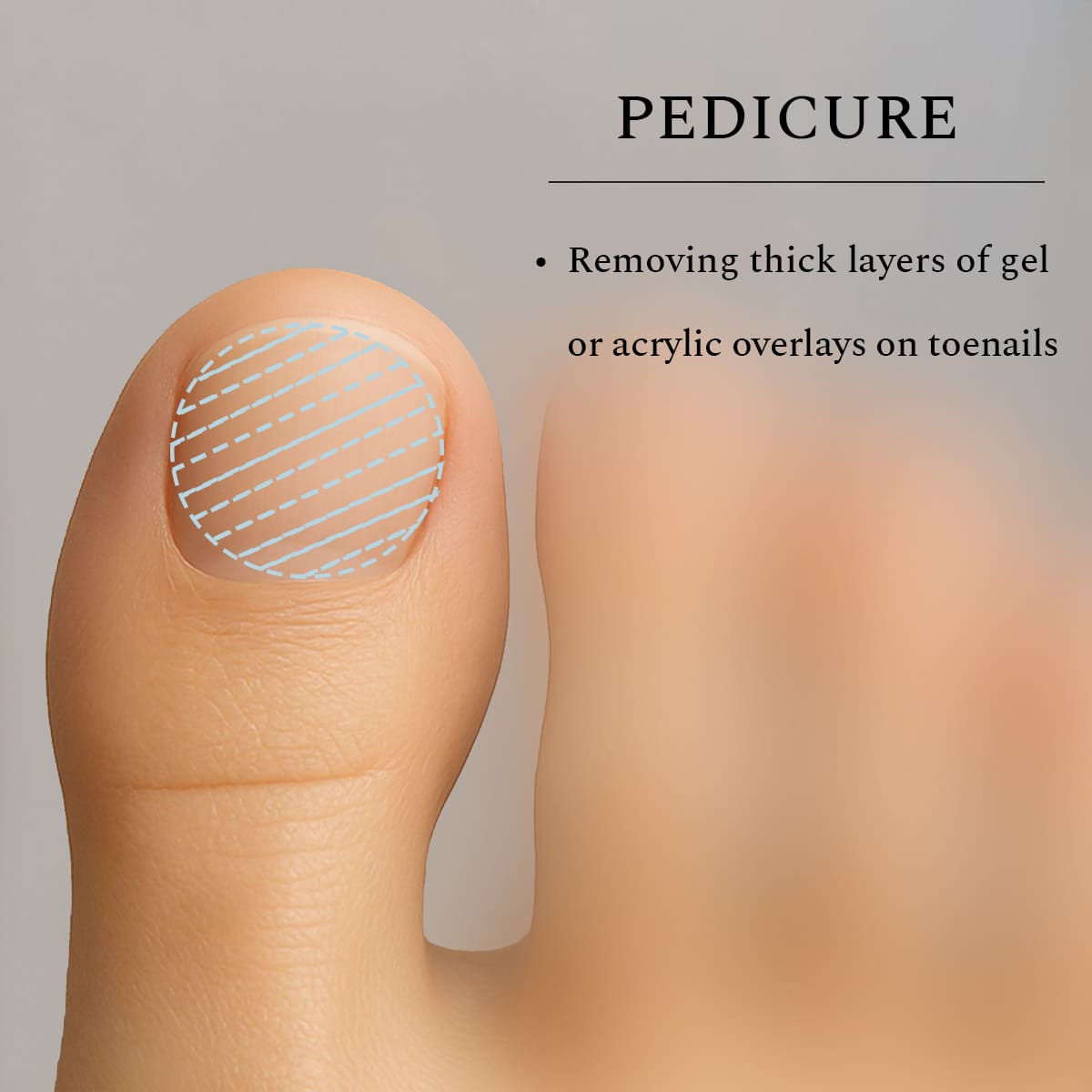 Carbide Bit Corn Medium, 5 mm