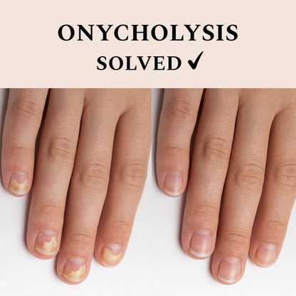 Nail Recover, 12 ml.