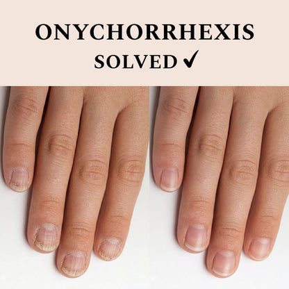 Nail Recover, 12 ml.